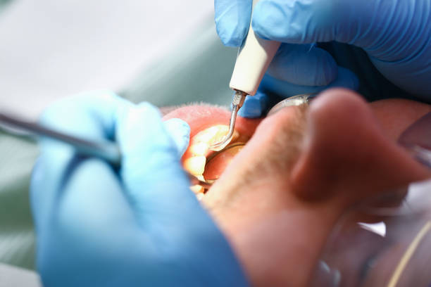 Best Emergency Cosmetic Dentistry in Palmview, TX