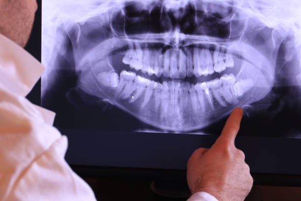 Best Emergency Dentist for Knocked-Out Tooth in Palmview, TX